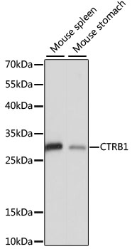 Western blot - CTRB1 Polyclonal Antibody 