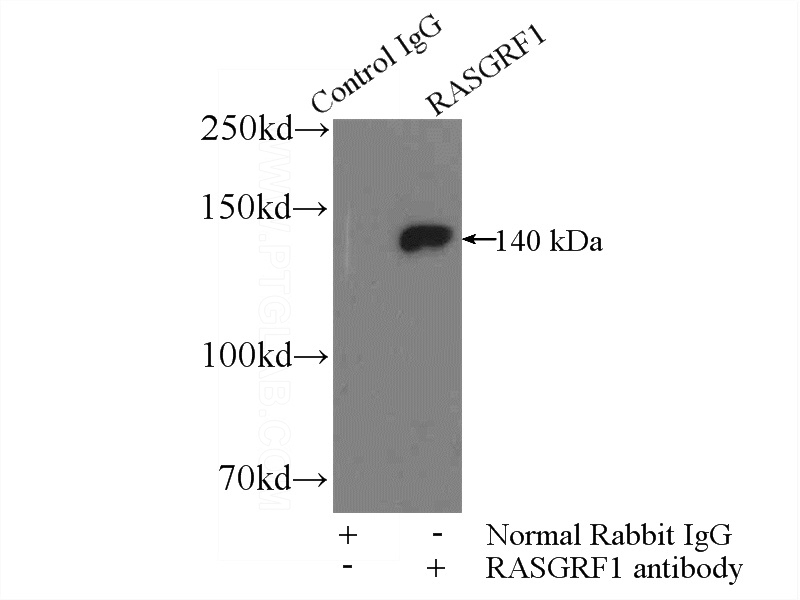 IP Result of anti-RASGRF1 (IP:Catalog No:114477, 4ug; Detection:Catalog No:114477 1:500) with rat brain tissue lysate 4000ug.