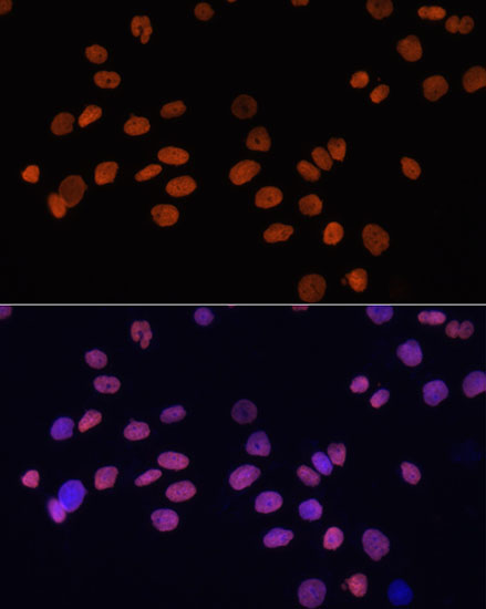 Immunofluorescence - GATA4 Monoclonal Antibody 