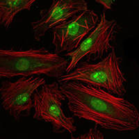 Immunofluorescence analysis of Hela cells using CREB1 mouse mAb (green). Red