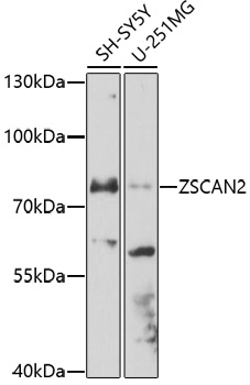 Western blot - ZSCAN2 Polyclonal Antibody 