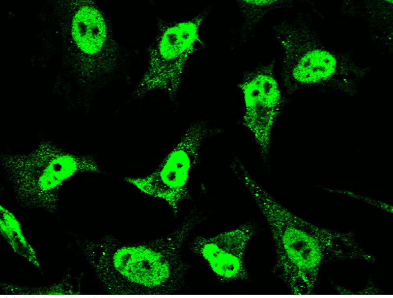 Human NR3C2 Immunofluorescence(IF) 15697