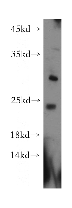 human brain tissue were subjected to SDS PAGE followed by western blot with Catalog No:108682(C1orf83 antibody) at dilution of 1:300