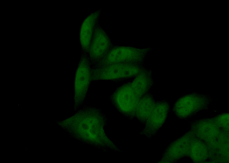 Immunofluorescent analysis of (10% Formaldehyde) fixed HeLa cells using Catalog No:115440(SNAI1 Antibody) at dilution of 1:50 and Alexa Fluor 488-congugated AffiniPure Goat Anti-Rabbit IgG(H+L)