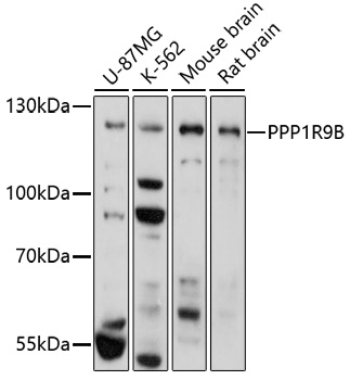 Western blot - PPP1R9B Polyclonal Antibody 