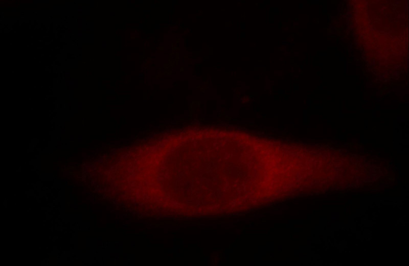 Immunofluorescent analysis of Hela cells, using NFKBIA antibody Catalog No:111639 at 1:25 dilution and Rhodamine-labeled goat anti-rabbit IgG (red).