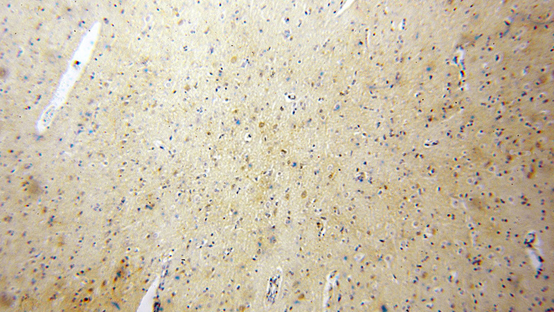 Immunohistochemical of paraffin-embedded human brain using Catalog No:113775(PGAM1 antibody) at dilution of 1:50 (under 10x lens)