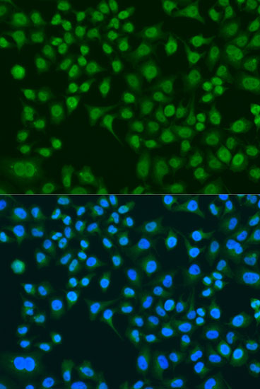Immunofluorescence - LRRK2 Polyclonal Antibody 