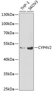 Western blot - CYP4V2 Polyclonal Antibody 