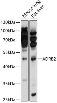Western blot - ADRB2 Polyclonal Antibody 