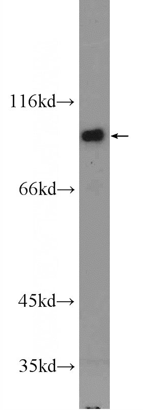 NIH/3T3 cells were subjected to SDS PAGE followed by western blot with Catalog No:111671(IFT80 Antibody) at dilution of 1:1000