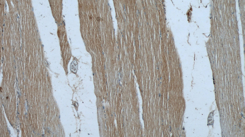 Immunohistochemical of paraffin-embedded human skeletal muscle using Catalog No:115786(SYNM antibody) at dilution of 1:50 (under 10x lens)