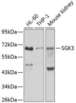 Western blot - SGK3 Polyclonal Antibody 