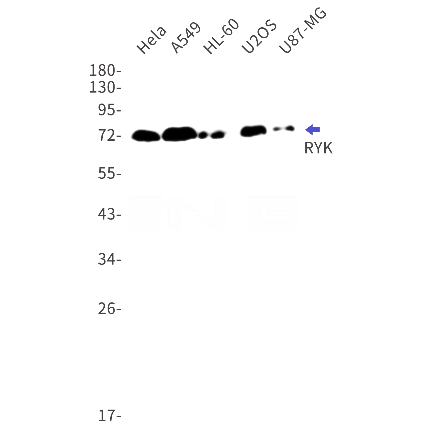 Western blot detection of RYK in Hela,A549,HL-60,U2OS,U87-MG cell lysates using RYK Rabbit mAb(1:1000 diluted).Predicted band size:68kDa.Observed band size:72kDa.