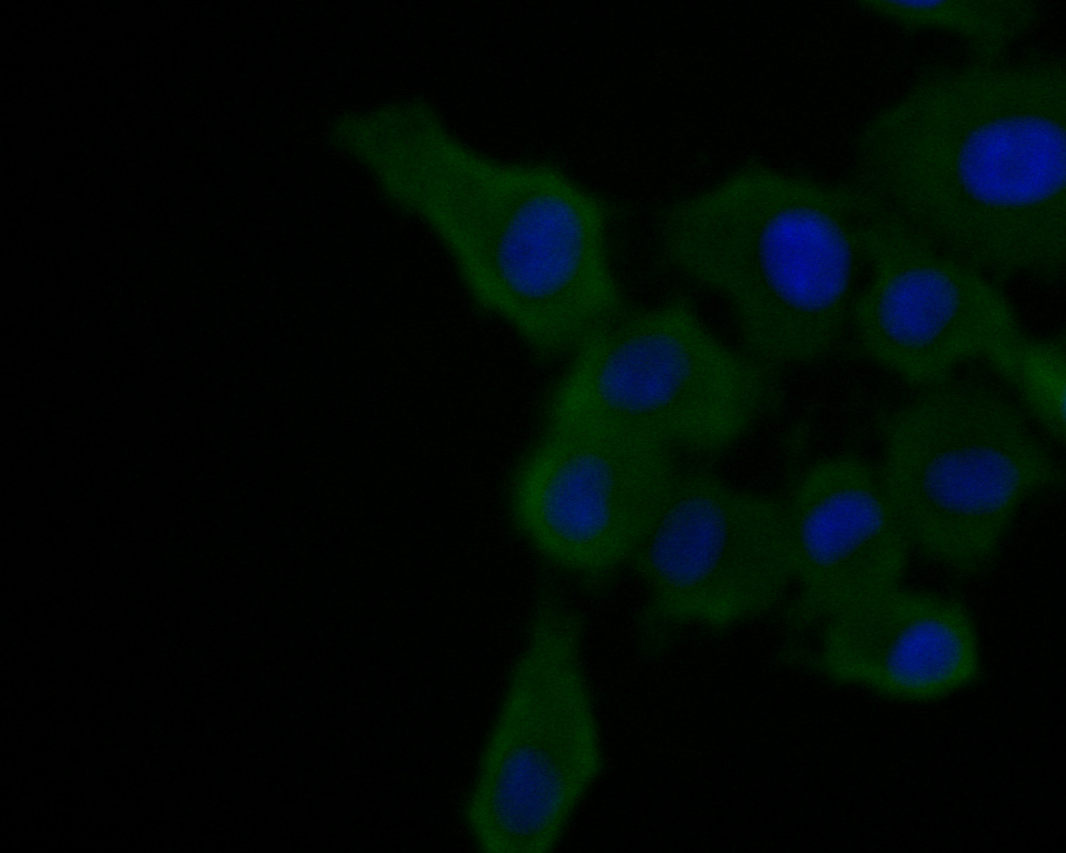 Fig4:; ICC staining of Alpha-2-macroglobulin in HepG2 cells (green). Formalin fixed cells were permeabilized with 0.1% Triton X-100 in TBS for 10 minutes at room temperature and blocked with 1% Blocker BSA for 15 minutes at room temperature. Cells were probed with the primary antibody ( 1/100) for 1 hour at room temperature, washed with PBS. Alexa Fluor®488 Goat anti-Rabbit IgG was used as the secondary antibody at 1/1,000 dilution. The nuclear counter stain is DAPI (blue).