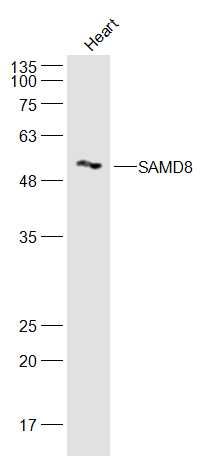 Fig1: Sample:; Heart(Mouse) Cell Lysate at 40 ug; Primary: Anti-SAMD8 at 1/300 dilution; Secondary: IRDye800CW Goat Anti-Rabbit IgG at 1/20000 dilution; Predicted band size: 48 kD; Observed band size: 48 kD
