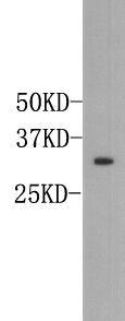 Fig1:; Western blot analysis of Osteopontin on mouse liver tissue lysate. Proteins were transferred to a PVDF membrane and blocked with 5% BSA in PBS for 1 hour at room temperature. The primary antibody ( 1/1000) was used in 5% BSA at room temperature for 2 hours. Goat Anti-Rabbit IgG - HRP Secondary Antibody (HA1001) at 1:5,000 dilution was used for 1 hour at room temperature.
