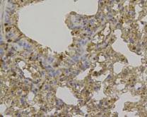 Fig4: Immunohistochemical analysis of paraffin- embedded mouse lung tissue using anti-CCL3 rabbit polyclonal antibody.