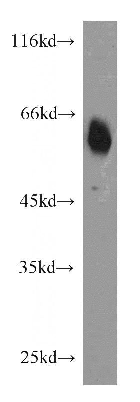 mouse brain tissue were subjected to SDS PAGE followed by western blot with Catalog No:108921(CAMK2G antibody) at dilution of 1:1000