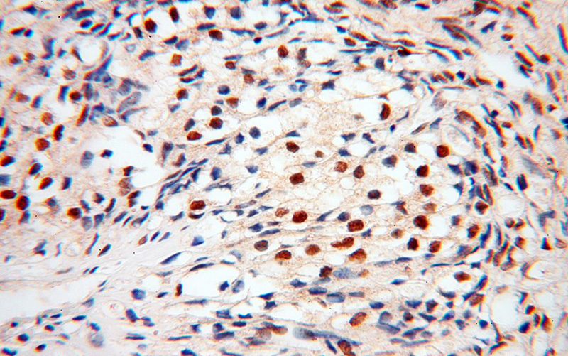 Immunohistochemical of paraffin-embedded human ovary using Catalog No:108378(BBX antibody) at dilution of 1:100 (under 40x lens)