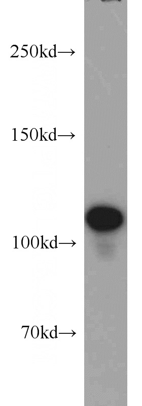 COLO 320 cells were subjected to SDS PAGE followed by western blot with Catalog No:113386(NUP98-NUP96 antibody) at dilution of 1:1000