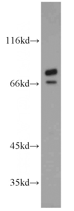 A549 cells were subjected to SDS PAGE followed by western blot with Catalog No:115853(TARS antibody) at dilution of 1:600
