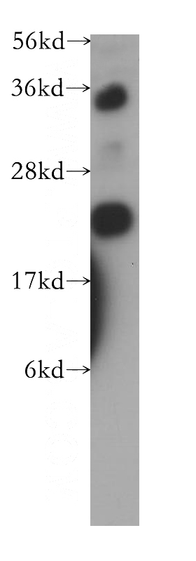 human heart tissue were subjected to SDS PAGE followed by western blot with Catalog No:107922(AK1 antibody) at dilution of 1:500