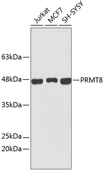 Western blot - PRMT8 Polyclonal Antibody 