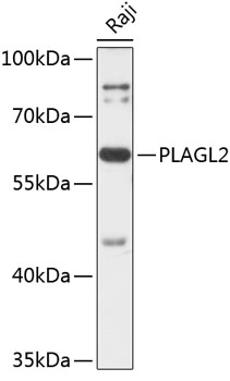 Western blot - PLAGL2 Polyclonal Antibody 