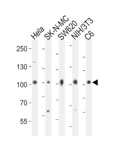 Western blot analysis of lysates from Hela, SK-N-MC, SW620, mouse NIH/3T3, rat C6 cell line (from left to right), using CTNNB1 Antibody (C-term)(Cat. #167158). 167158 was diluted at 1:1000 at each lane. A goat anti-rabbit IgG H&L(HRP) at 1:10000 dilution was used as the secondary antibody. Lysates at 20ug per lane.
