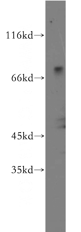 human brain tissue were subjected to SDS PAGE followed by western blot with Catalog No:117023(ZNF699 antibody) at dilution of 1:500