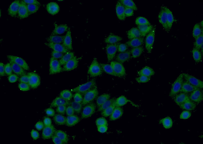 Immunofluorescent analysis of HeLa cells using Catalog No:115698(STMN1 Antibody) at dilution of 1:50 and Alexa Fluor 488-congugated AffiniPure Goat Anti-Rabbit IgG(H+L)