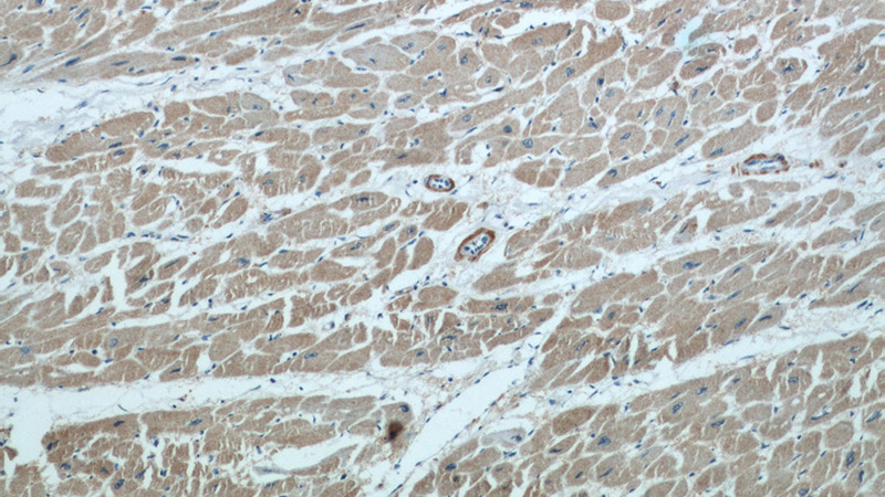 Immunohistochemical of paraffin-embedded human heart using Catalog No:110650(FHL2 antibody) at dilution of 1:50 (under 10x lens)