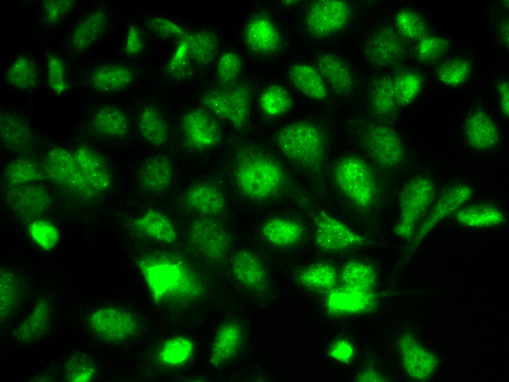 Immunofluorescence - BIRC2 Polyclonal Antibody 