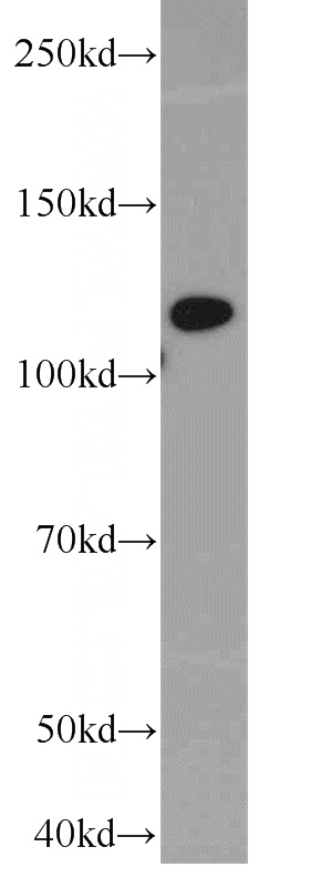 K-562 cells were subjected to SDS PAGE followed by western blot with Catalog No:108336(ACLY antibody) at dilution of 1:1000