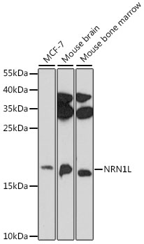 Western blot - NRN1L Polyclonal Antibody 