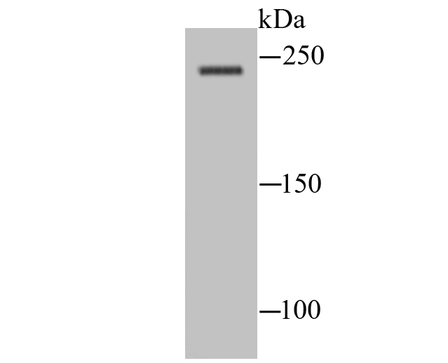 Fig1: Western blot analysis of NaV1.8 on rat spinal cord lysate using anti-NaV1.8 antibody at 1/100 dilution.