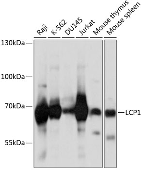 Western blot - LCP1 Polyclonal Antibody 