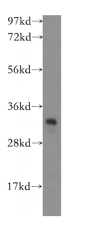 mouse small intestine tissue were subjected to SDS PAGE followed by western blot with Catalog No:110483(ETFA antibody) at dilution of 1:1000