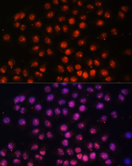 Immunofluorescence - TFEB Polyclonal Antibody 