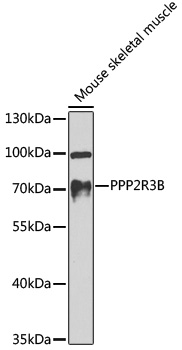 Western blot - PPP2R3B Polyclonal Antibody 
