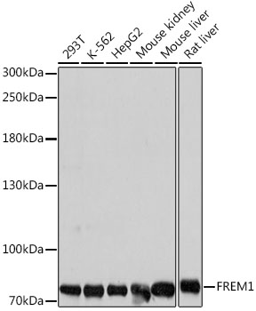 Western blot - FREM1 Polyclonal Antibody 