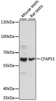 Western blot - CFAP53 Polyclonal Antibody 