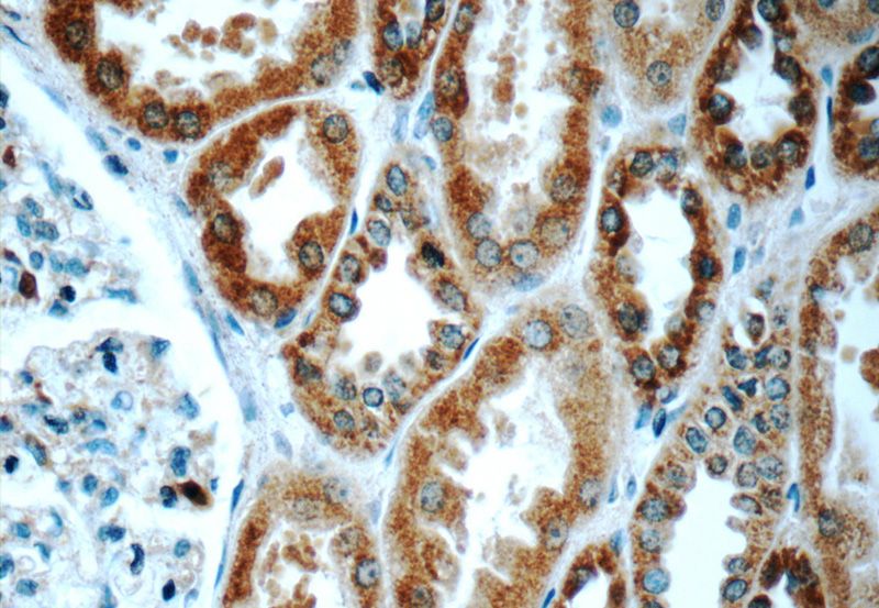 Immunohistochemistry of paraffin-embedded human kidney tissue slide using Catalog No:116177(TMEM213 Antibody) at dilution of 1:50 (under 40x lens)