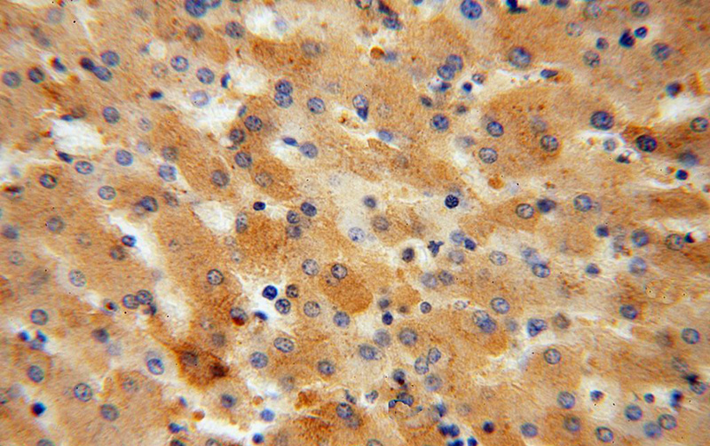 Immunohistochemical of paraffin-embedded human liver using Catalog No:111339(HP antibody) at dilution of 1:50 (under 40x lens)