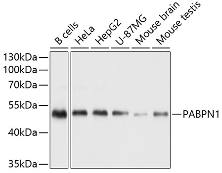 Western blot - PABPN1 Polyclonal Antibody 