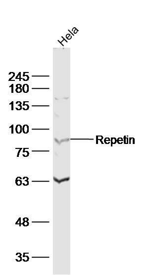 Fig2: Sample:; Hela(human)cell Lysate at 40 ug; Primary: Anti- repetin at 1/300 dilution; Secondary: IRDye800CW Goat Anti-Rabbit IgG at 1/20000 dilution; Predicted band size: 91kD; Observed band size: 91 kD