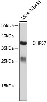 Western blot - DHRS7 Polyclonal Antibody 
