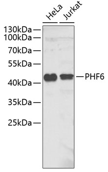 Western blot - PHF6 Polyclonal Antibody 
