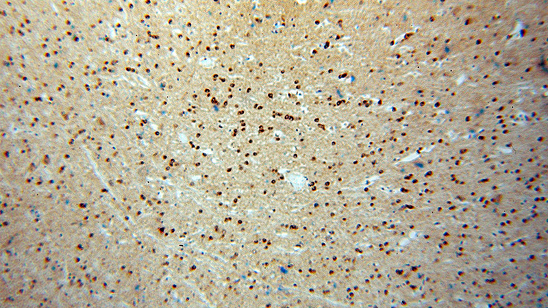 Immunohistochemical of paraffin-embedded human brain using Catalog No:114418(RAB2A antibody) at dilution of 1:100 (under 10x lens)